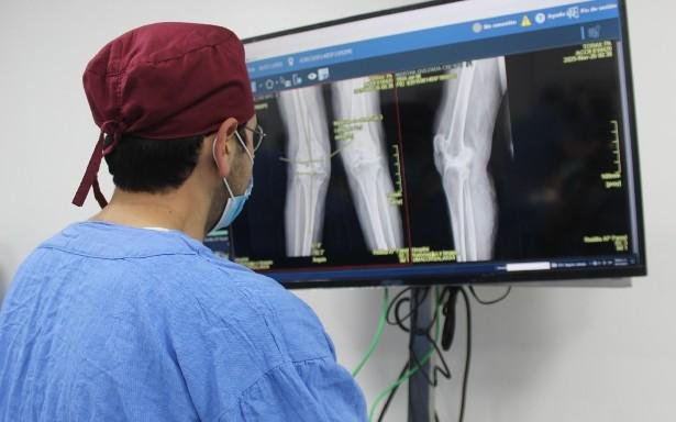El IMSS incorpora cirugía robótica para reemplazo de rodilla que reduce sangrado, dolor y tiempo de recuperación en pacientes